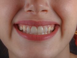 Tingkatkan Kepercayaan Diri dengan Parfum Odol Pertama di Dunia dari usmile